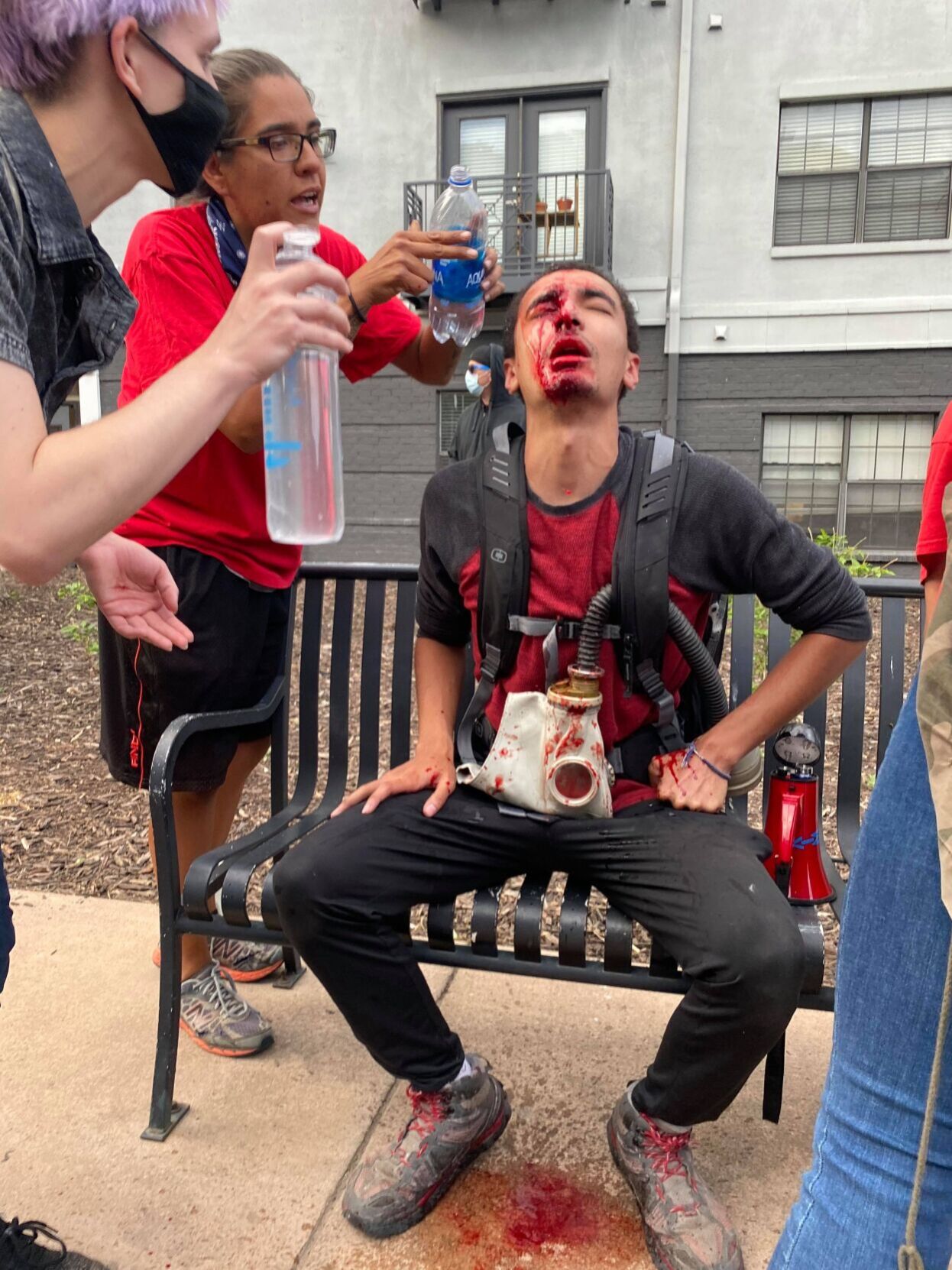 Denver to pay $500,000 to student shot by police during George Floyd protest