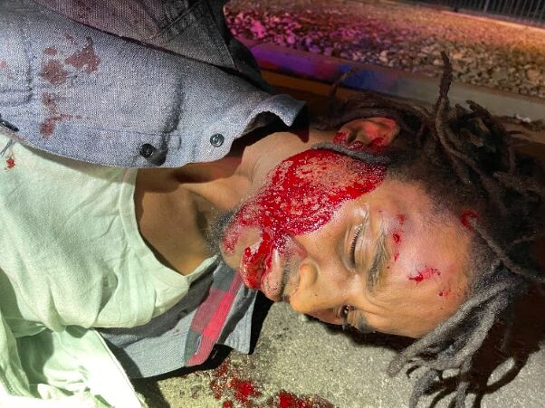 DOJ to consider investigating Colorado Springs police regarding the beating of Black homeless man