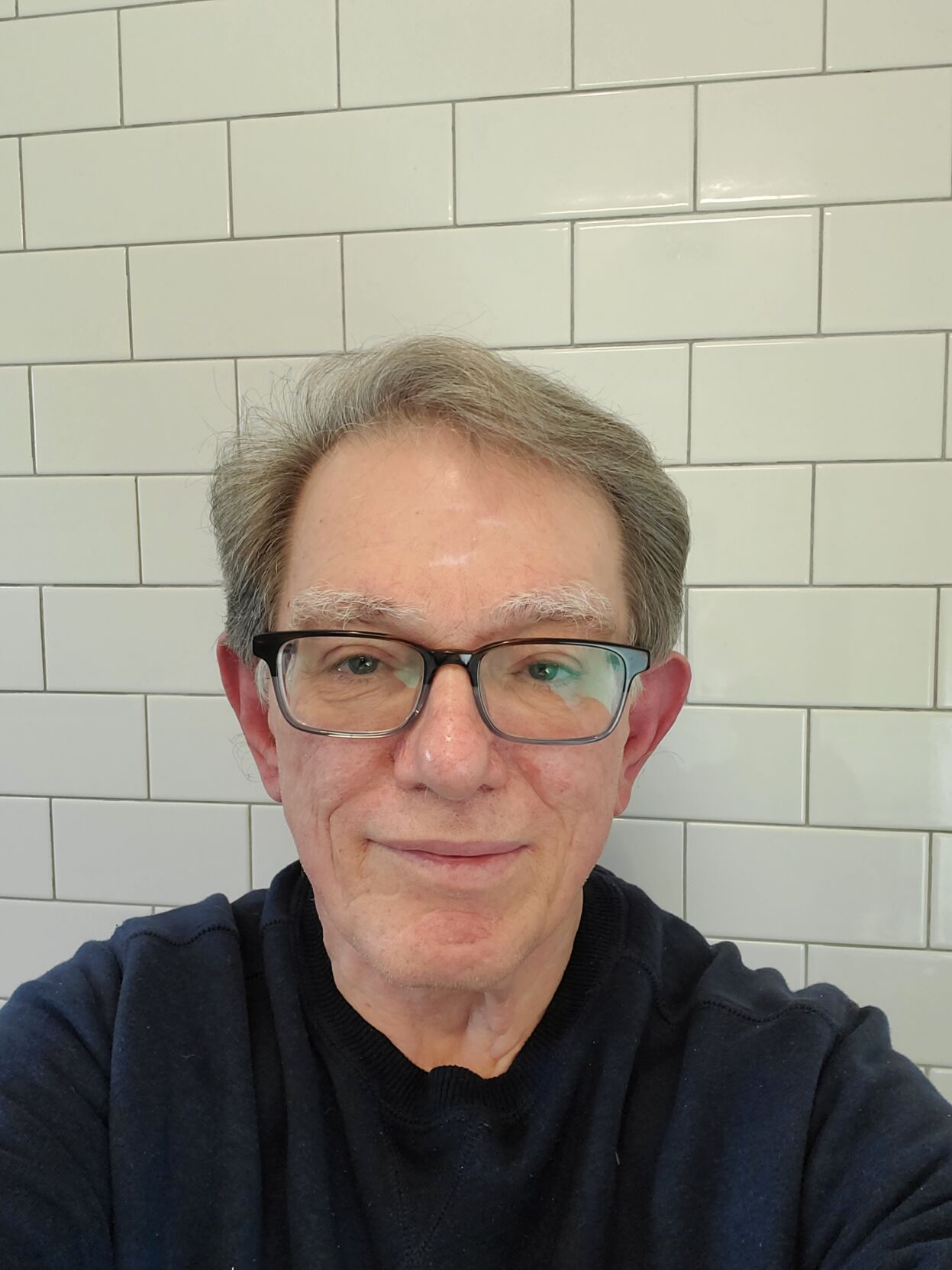 Time to rein in hospital facility fees | OPINION